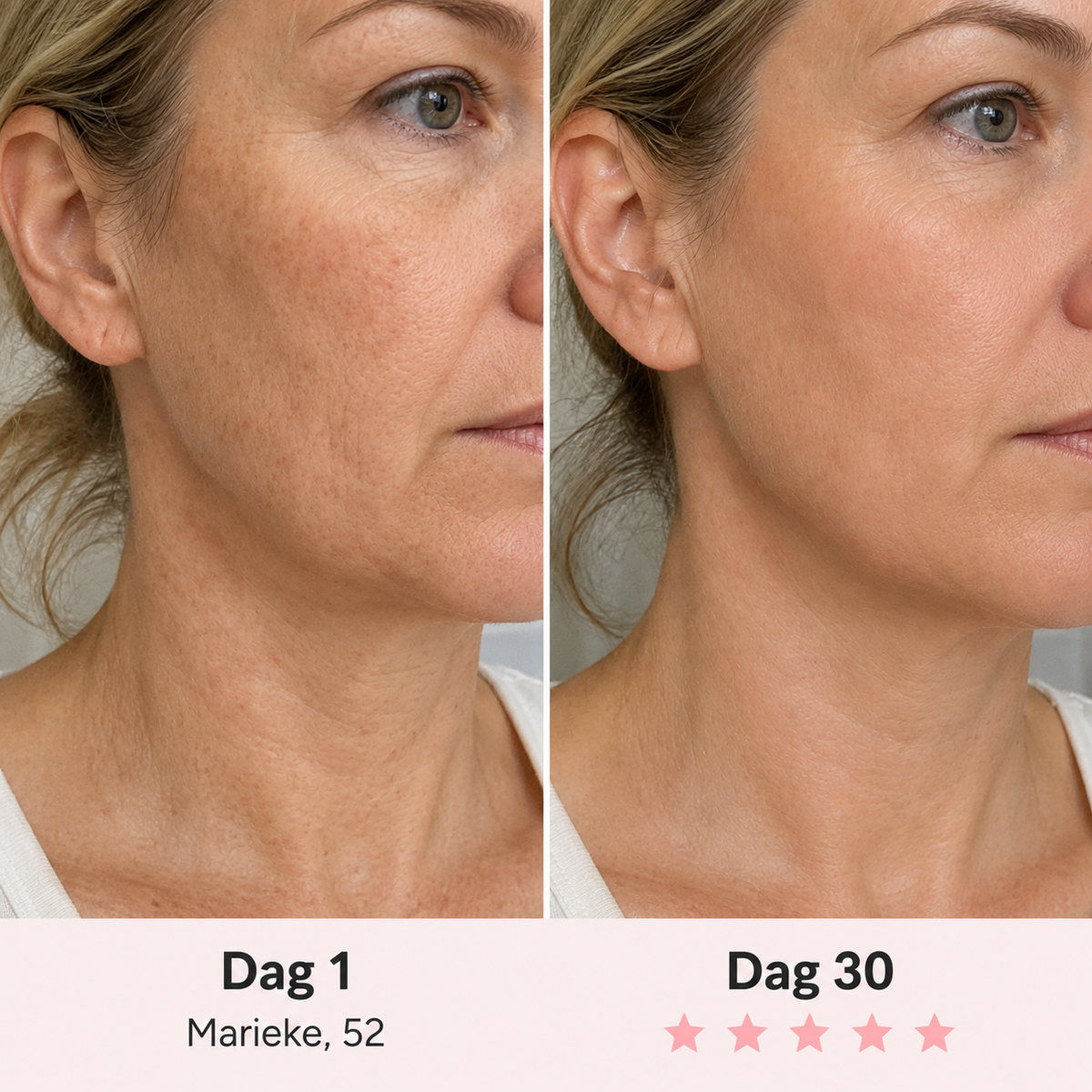 Liness™ Face Sculpt Pro