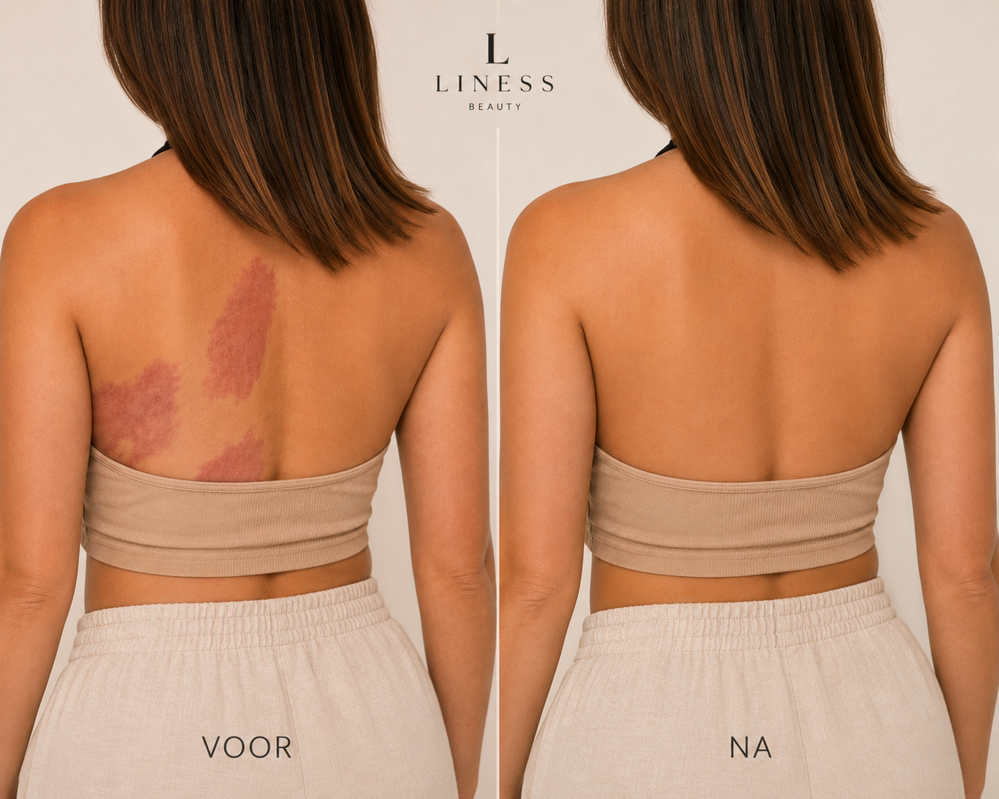 Liness Perfect Skin™ Body Coverage Perfector