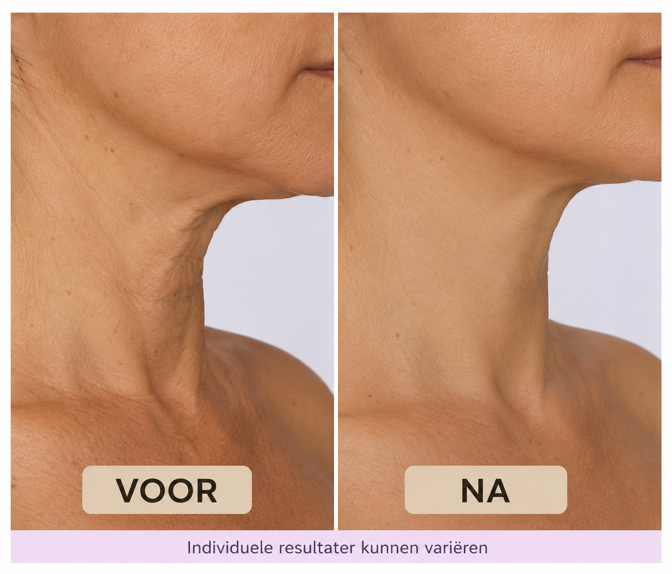 Liness™ Liness™ Neck Lift Cream