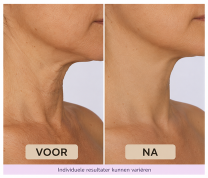 Liness™ Liness™ Neck Lift Cream
