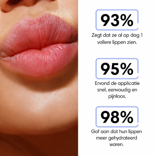VelouraKiss – Zijdezachte Lipverzorging